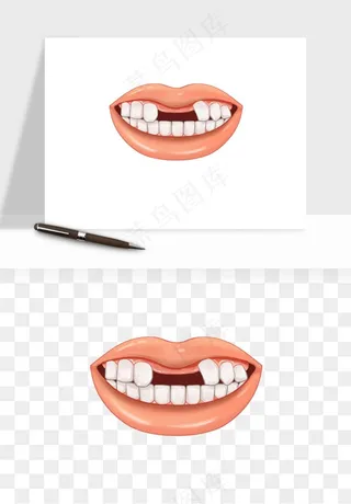 手绘牙齿矫正拔牙png免抠