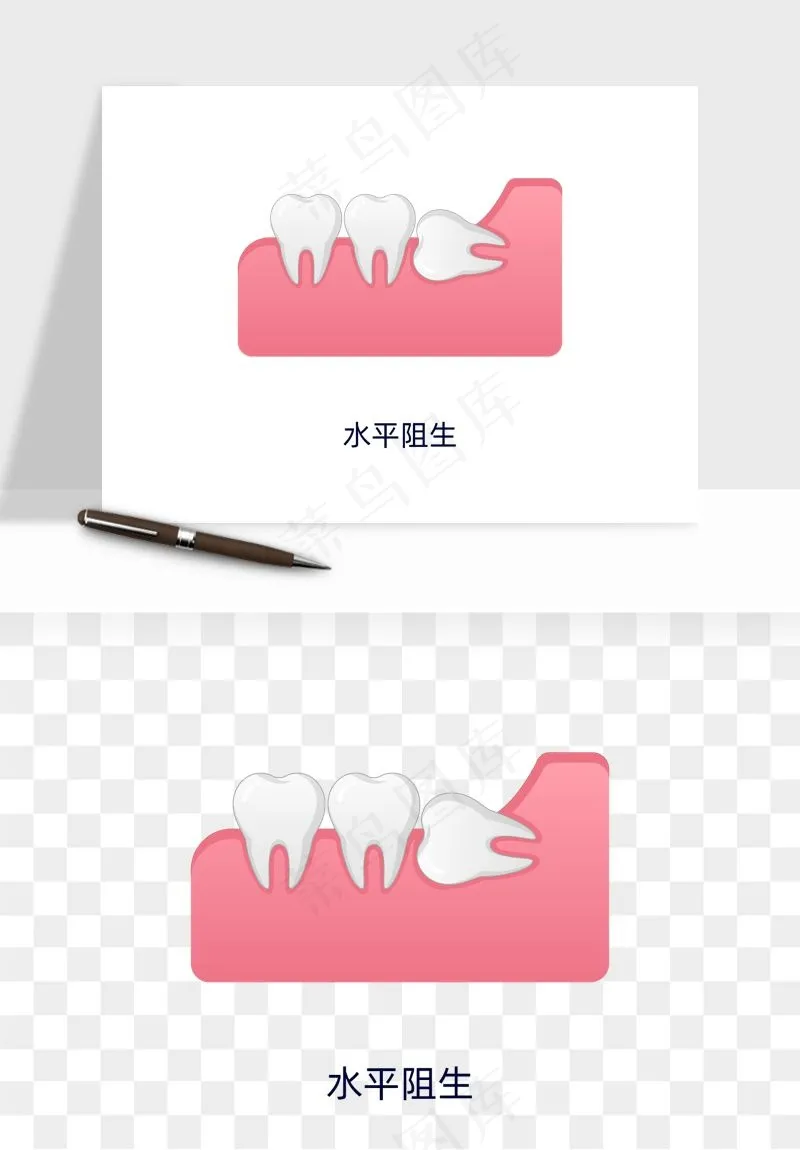 手绘牙齿矫正拔牙png免抠