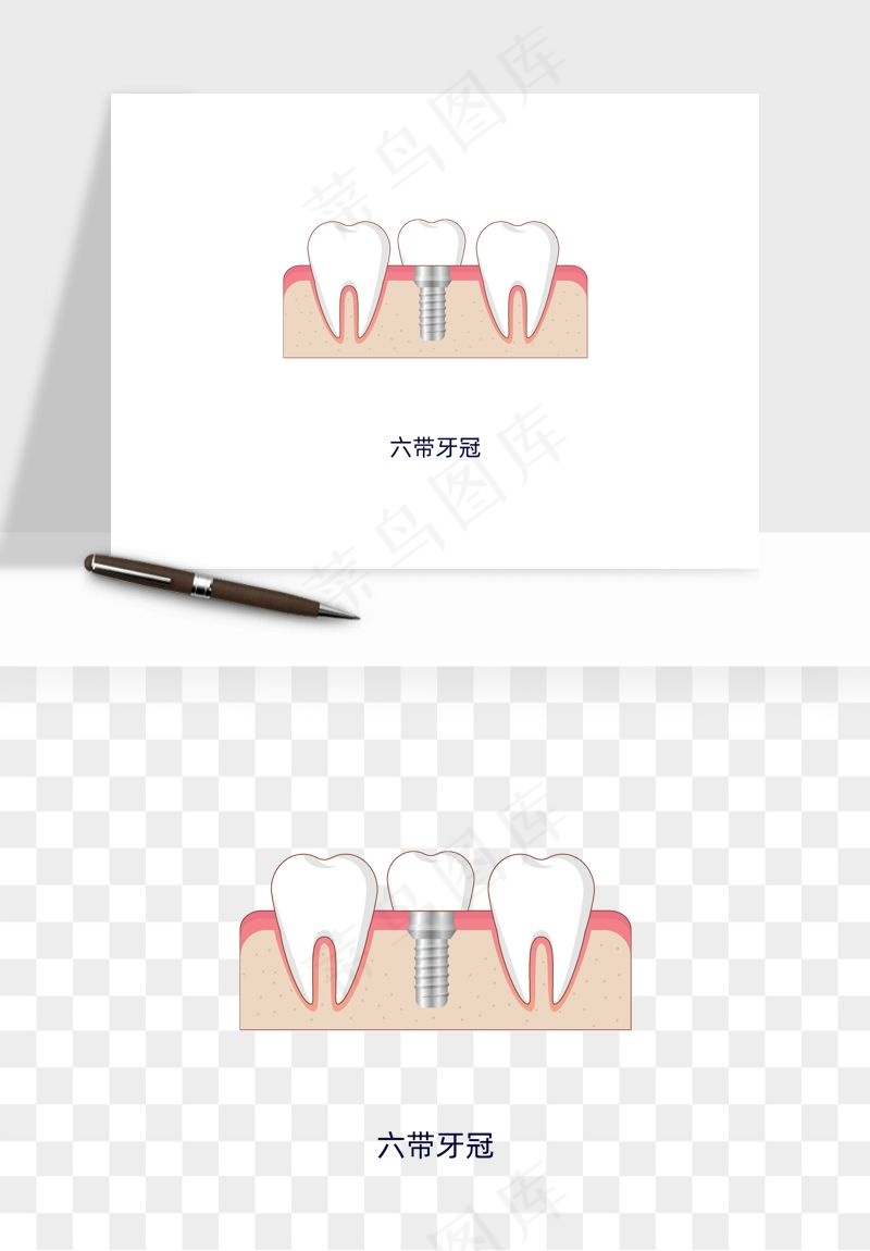 手绘牙齿矫正拔牙png免抠