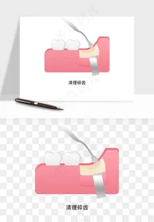 手绘牙齿矫正拔牙png免抠