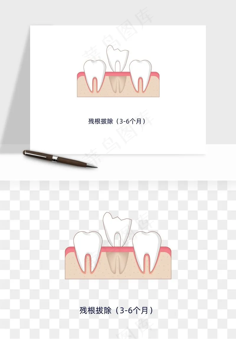 手绘牙齿矫正拔牙png免抠