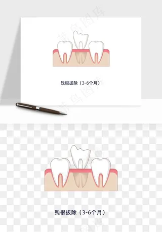 手绘牙齿矫正拔牙png免抠