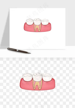 手绘牙齿矫正拔牙png免抠