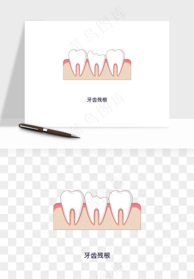 手绘牙齿矫正拔牙png免抠