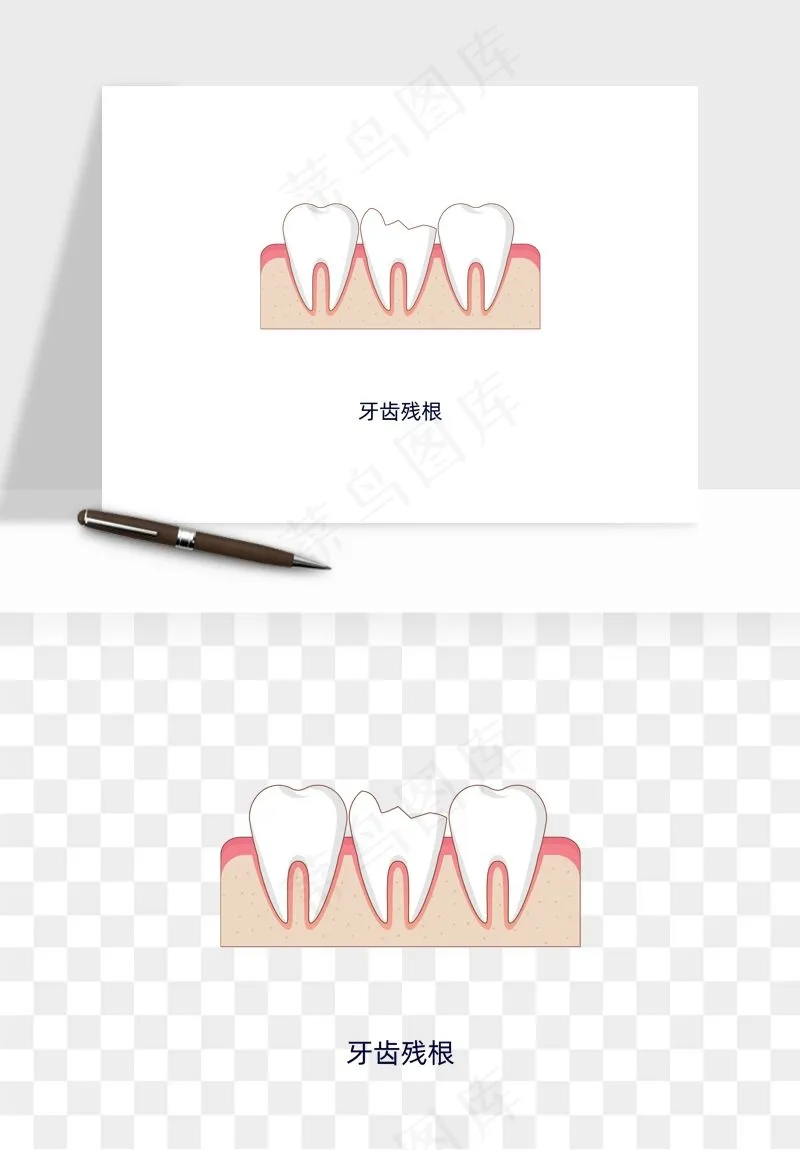 手绘牙齿矫正拔牙png免抠