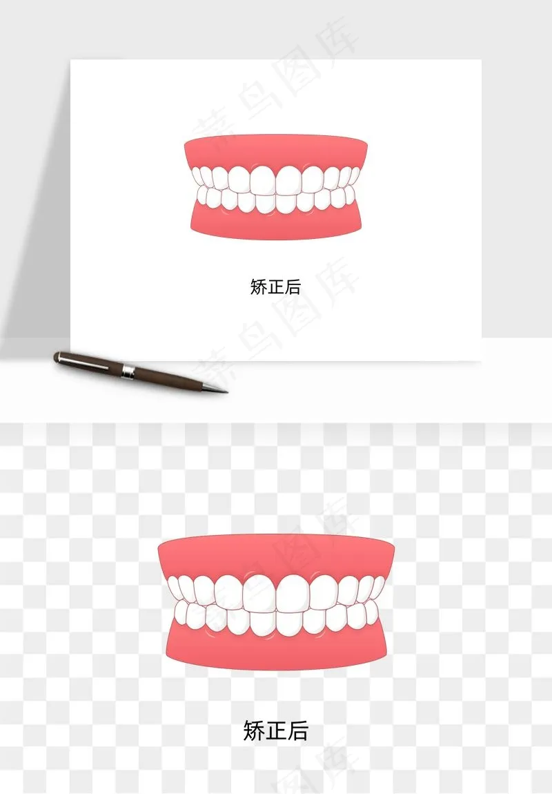 手绘牙齿矫正拔牙png免抠