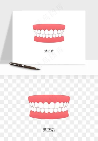 手绘牙齿矫正拔牙png免抠