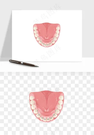 手绘牙齿矫正拔牙png免抠