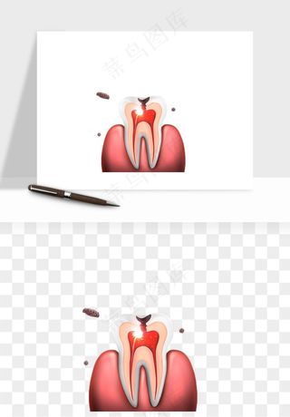 手绘牙齿矫正拔牙png免抠