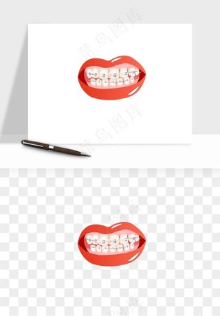 手绘牙齿矫正拔牙png免抠