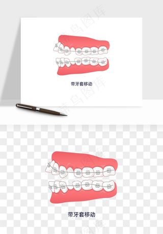 手绘牙齿矫正拔牙png免抠