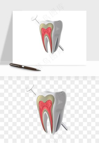 手绘牙齿矫正拔牙png免抠