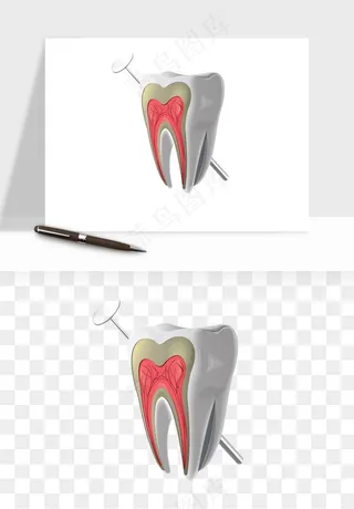 手绘牙齿矫正拔牙png免抠
