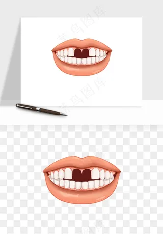 手绘牙齿矫正拔牙png免抠