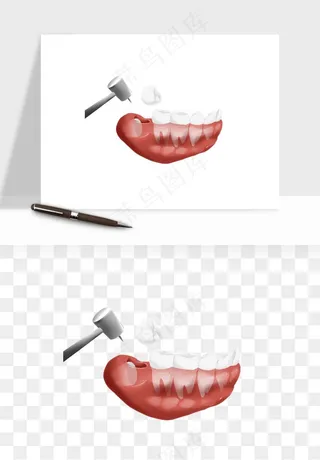 手绘牙齿矫正拔牙png免抠