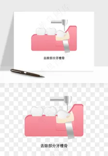 手绘牙齿矫正拔牙png免抠