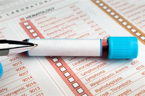 医疗试管特写图片