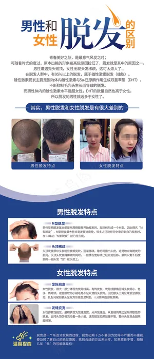 脱发易拉宝 皮肤病海报