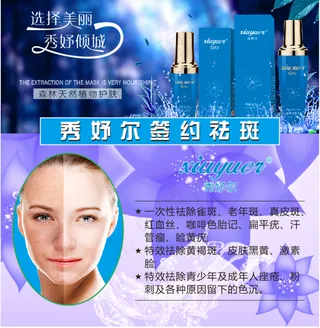 专业点痣 祛痣祛斑 点痣宣传