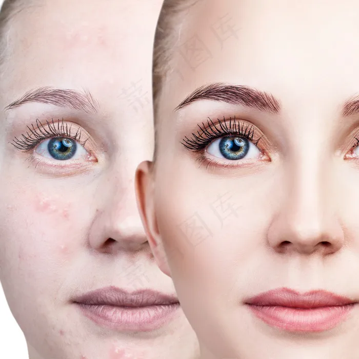 美容美白护肤图片