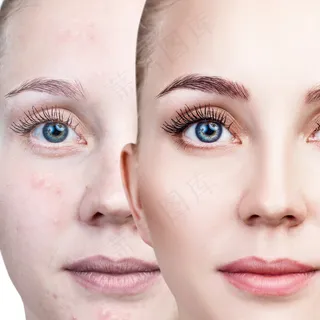 美容美白护肤图片