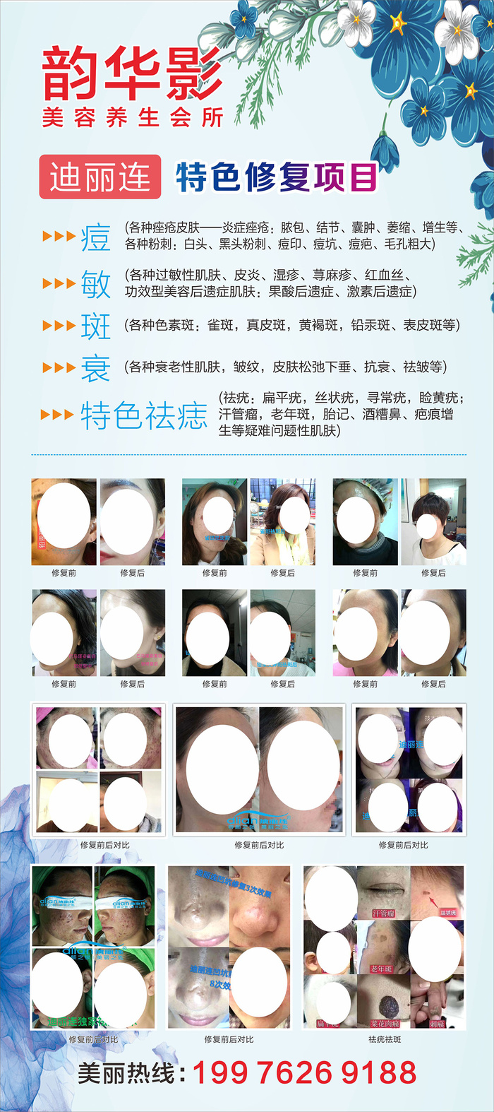 医疗美容展架cdr矢量模版下载