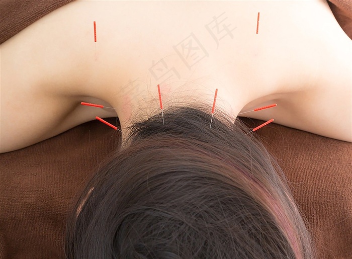 美女养生针灸摄影