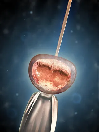 干细胞显微注射高清图片