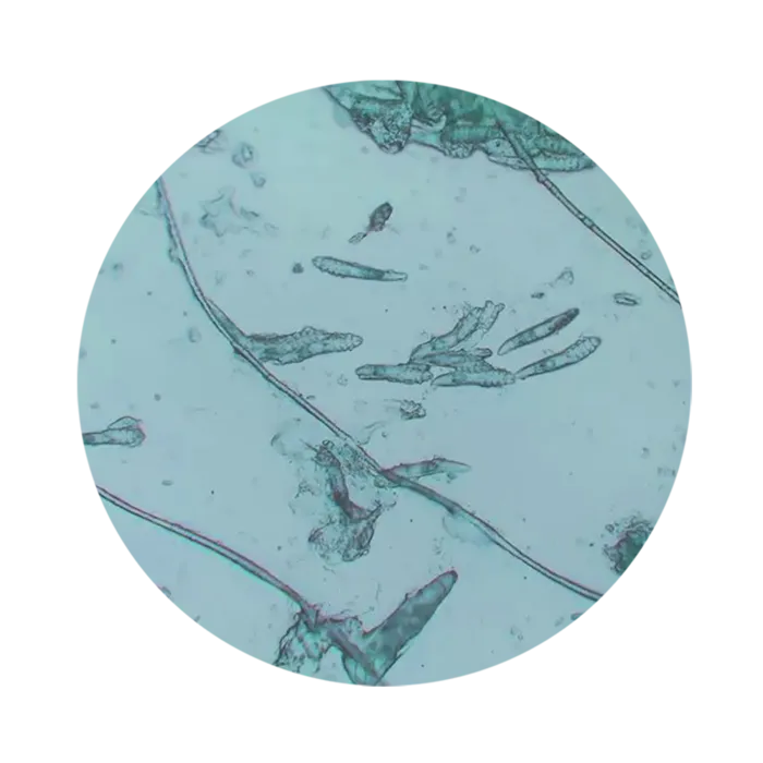 螨虫尘螨分泌物显微镜