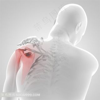 人体肩周炎透视高清图片