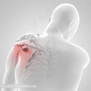 人体肩周炎透视高清图片