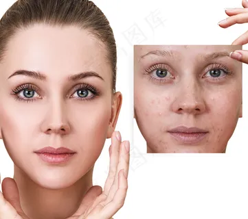 美女美容护肤前后图片