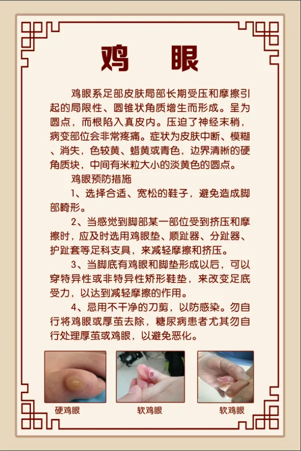 鸡眼简介展板psd模版下载