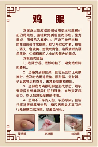 鸡眼简介展板