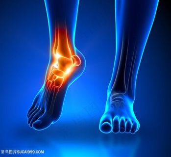 足关节疼痛医疗主题高清 人体器官图