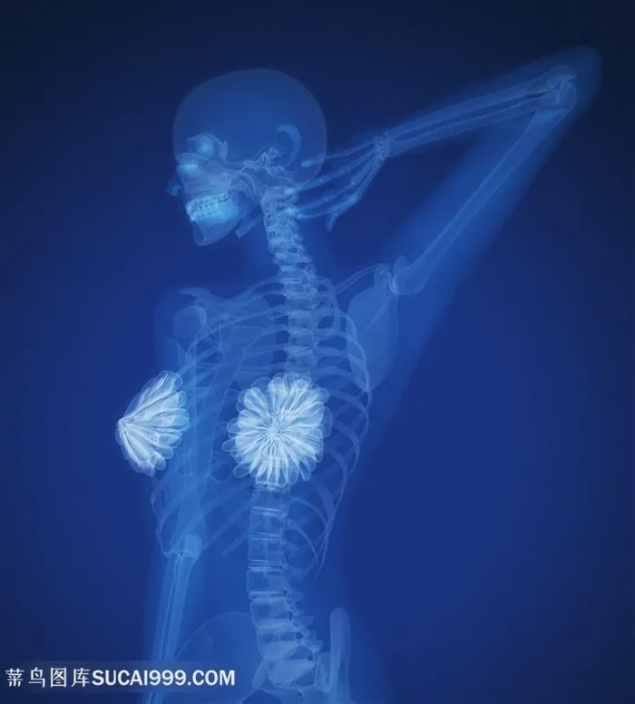 女性x光人物透视高清图片