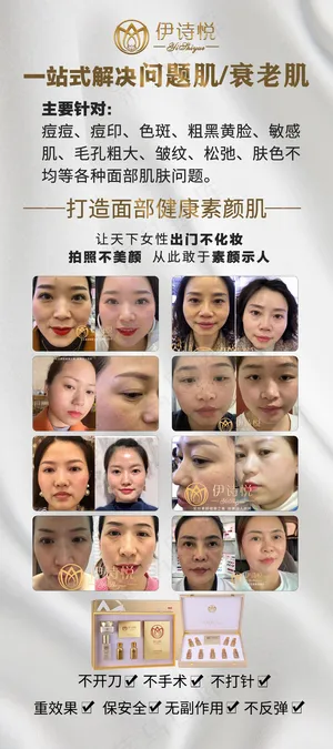 伊诗悦一站式解决问题肌肤展架 1