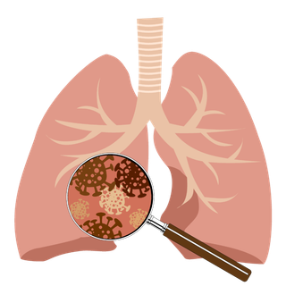 防疫 疫情 病毒