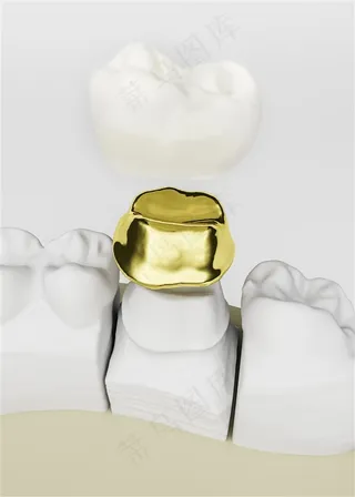 牙齿塑料模型设计素材