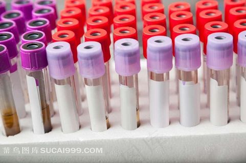 采血取样试管