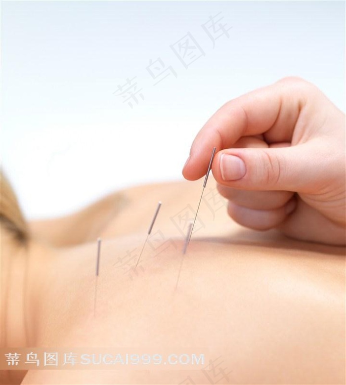 针灸美女图片美容图片