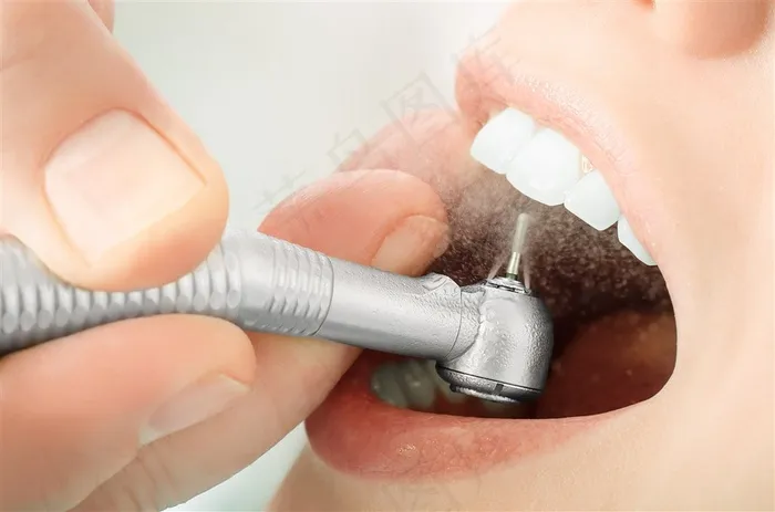 看牙拔牙的美女高清图片