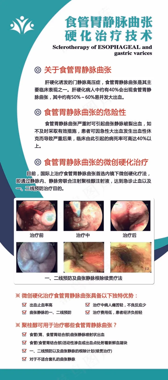 食管胃静脉曲张展架psd模版下载