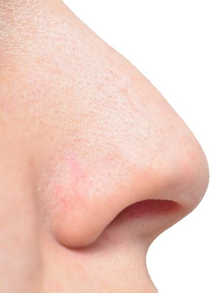 人的鼻子 PNG免抠(430x600)