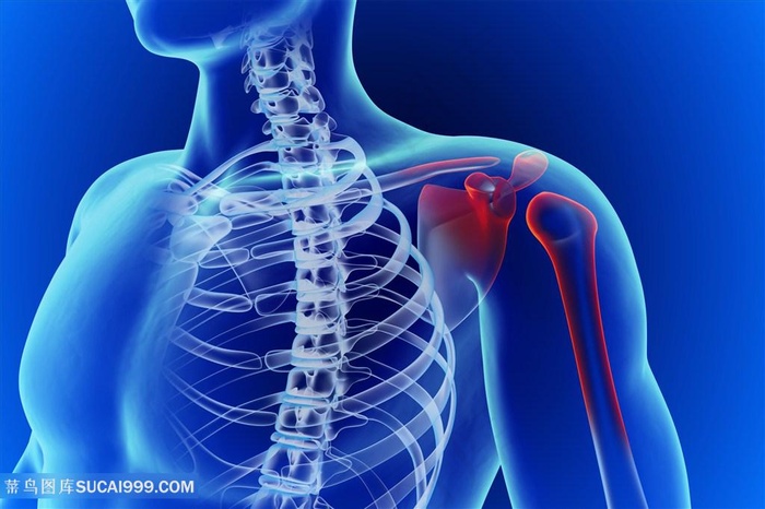 关节疼痛医疗主题高清