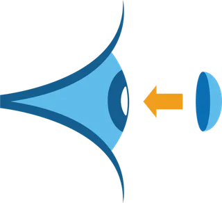 角膜塑形镜隐形眼镜