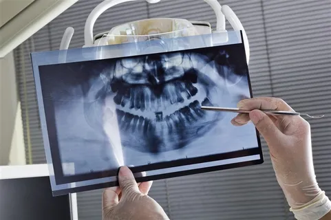 牙科护理系列 - 正在牙齿X光片检查的牙科医生