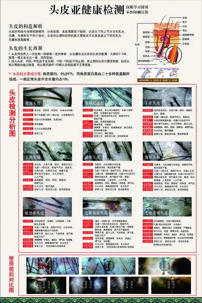 头皮亚健康检测海报cdr矢量模版下载
