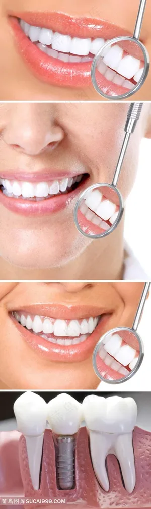 牙齿美白保健素材 牙齿美白保健素材