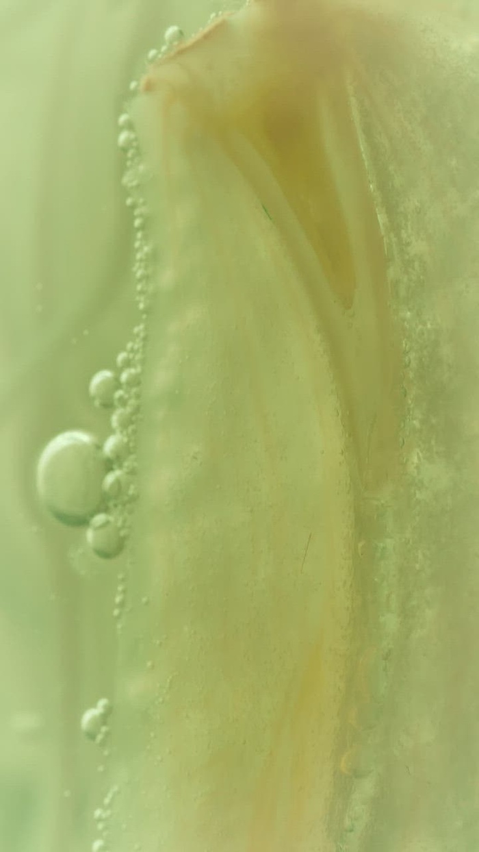 显微镜下的细菌菌株